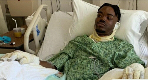 중화상 입은 남편 위리엄스     [인터넷 모금 사이트 고펀드미(gofundme) 제공]